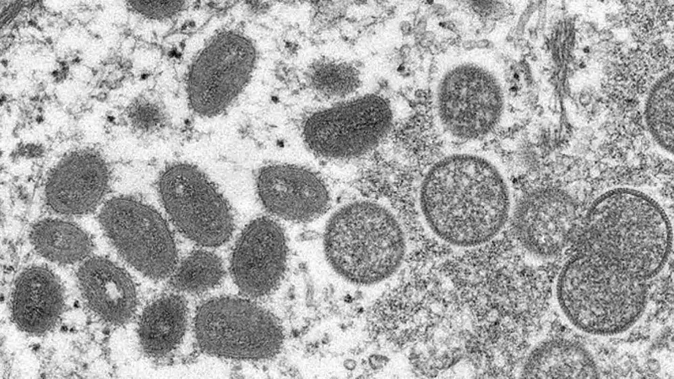 تصویر میکروسکوپی ویروس آبله میمونی